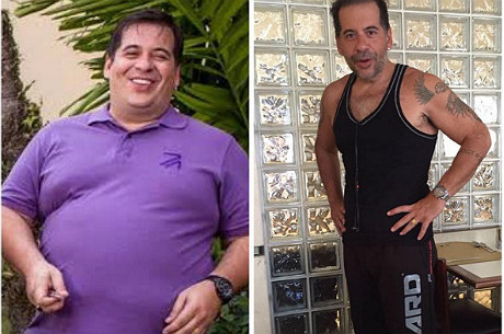 Veja antes e depois de 6 famosos que fizeram cirurgia para emagrecer