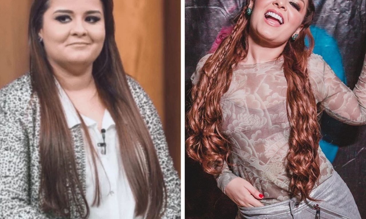 Veja antes e depois de 6 famosos que fizeram cirurgia para emagrecer